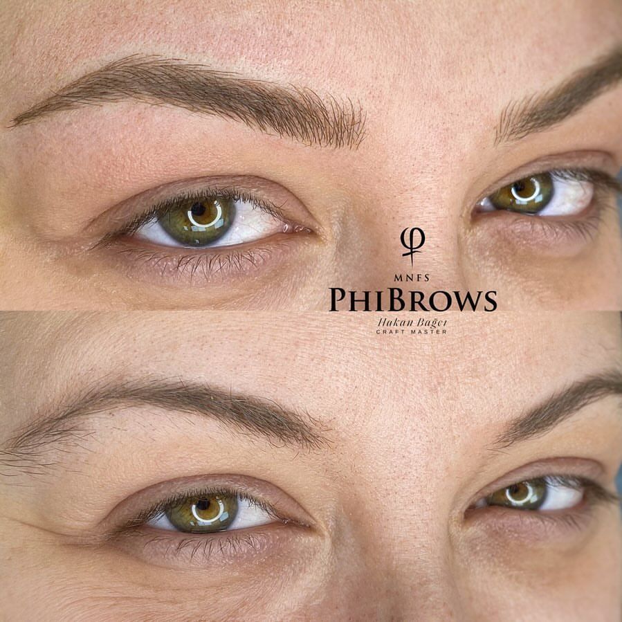 Microblading — Before / After · Hakan Bağcı