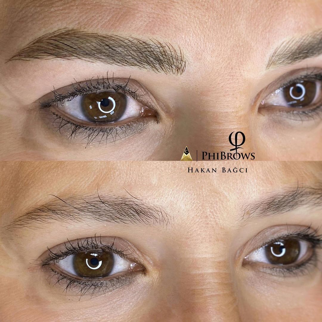Permanent eyeliner — Before / After · Hakan Bağcı